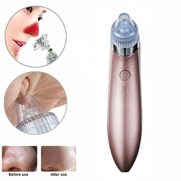 Electric Blackhead Remover - Pore Vacuum Cleaner with Diamond Dermabrasion for Deep Cleansing & Acne Removal - Image 9