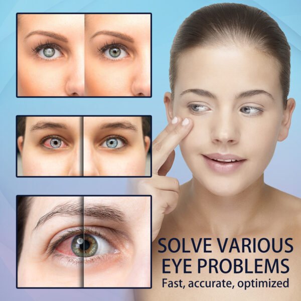 EELHOE Eye Drops - Relieve Redness, Dryness & Blurred Vision with Moisturizing Eye Care Solution - Image 6