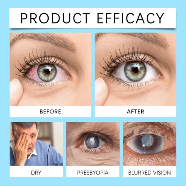 Eye Care Solution - Relieve Discomfort & Moisturize Eyes with Gentle, Soothing Formula - Image 5