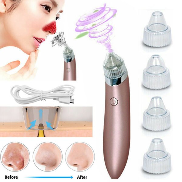 Electric Blackhead Remover - Pore Vacuum Cleaner with Diamond Dermabrasion for Deep Cleansing & Acne Removal